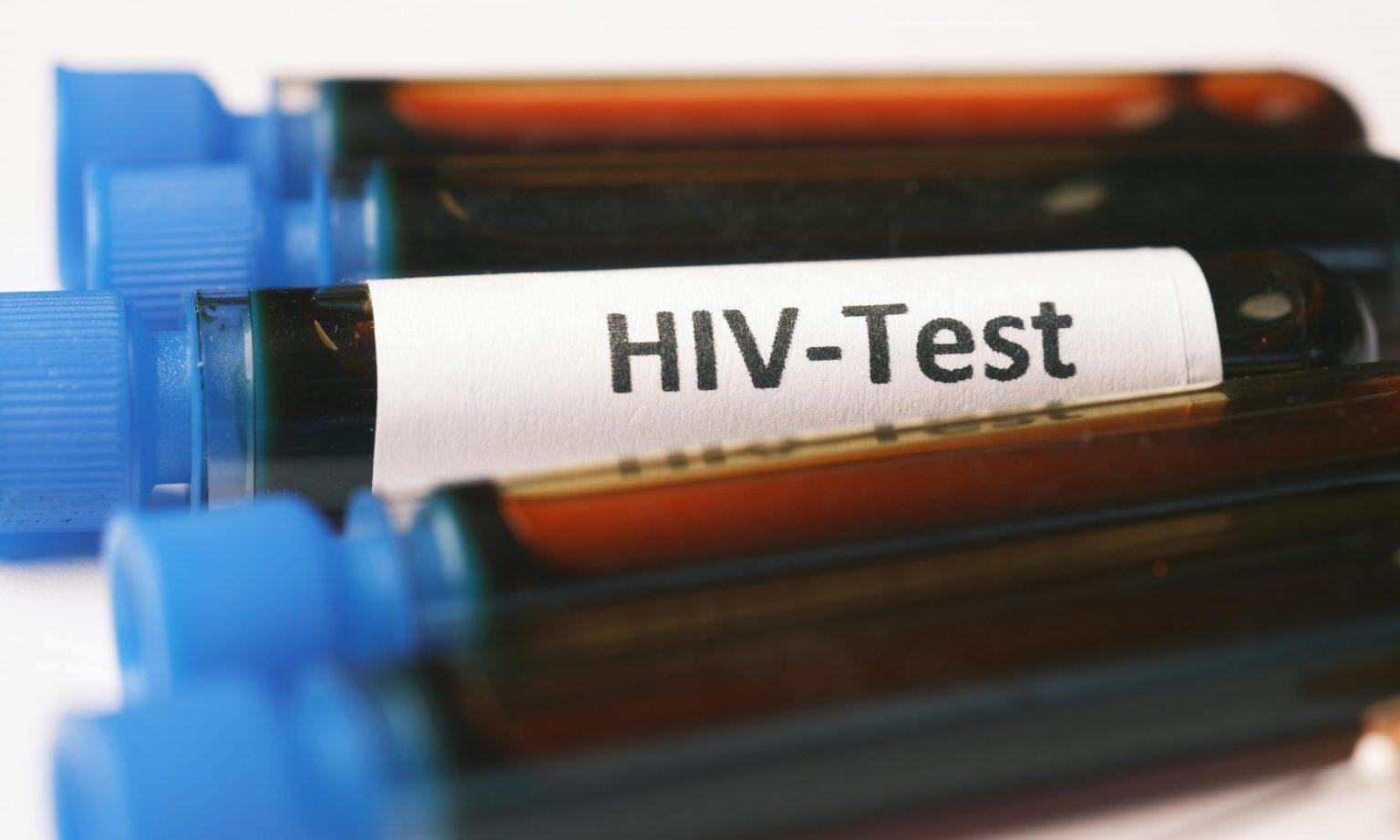 Probetas virus VIH.