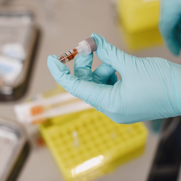 Hablemos de hepatitis sin miedo ni prejuicios